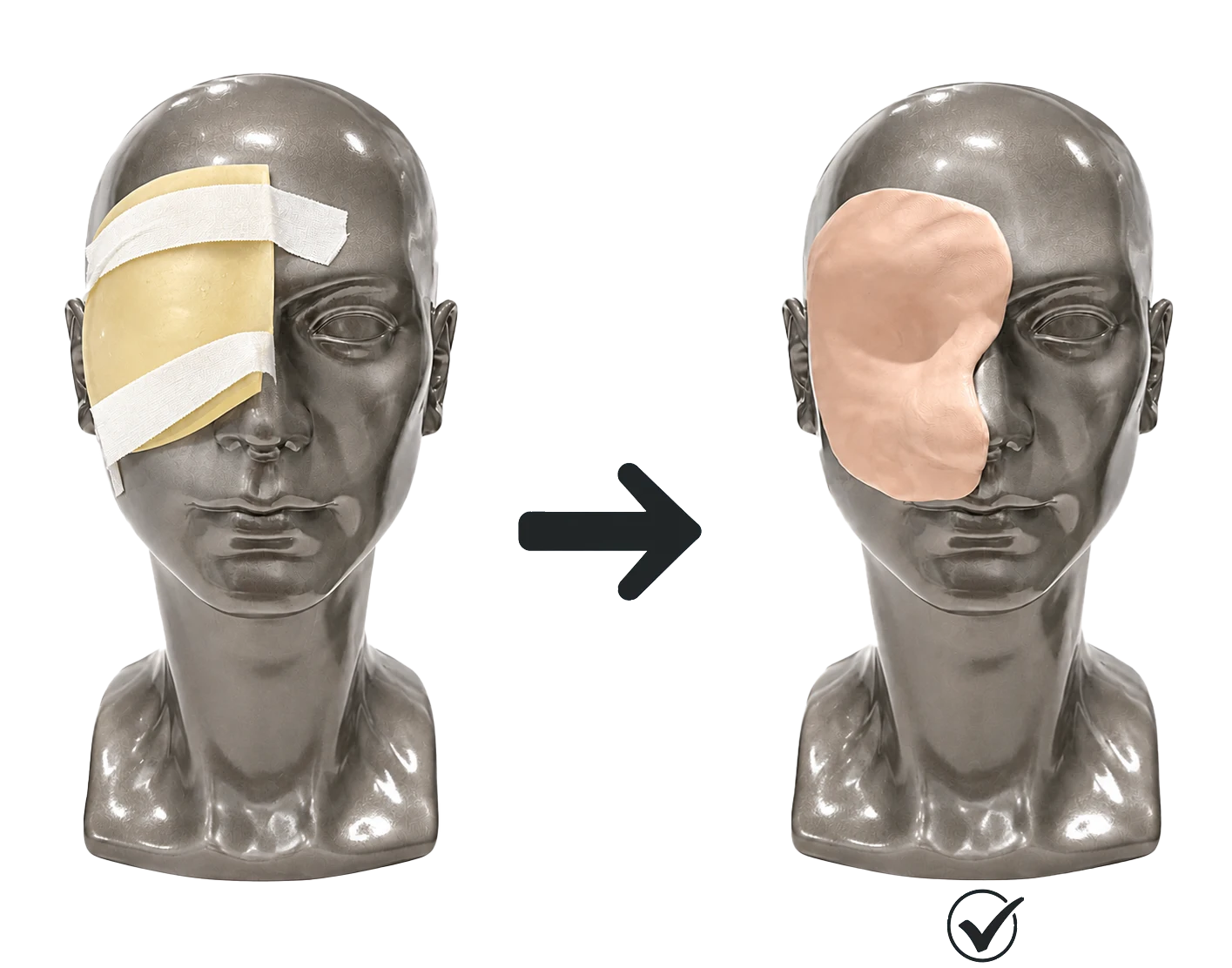 BolusCare radiation therapy bolus material